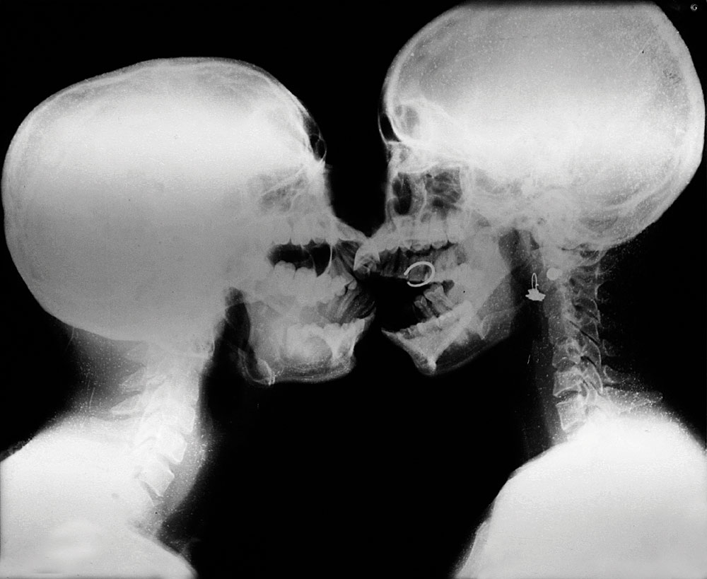 Yomer Fidel Montejo Harrys, "Beso transparente" (transparenter Kuß)